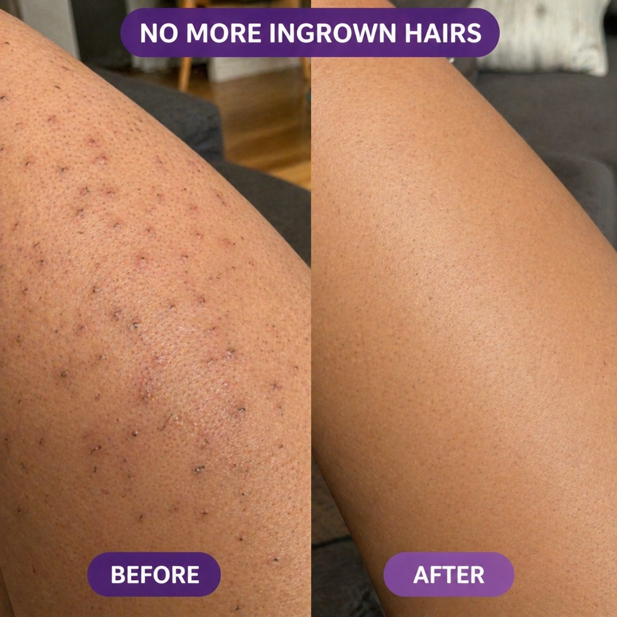 Kivora™ Hair Removal Mouse