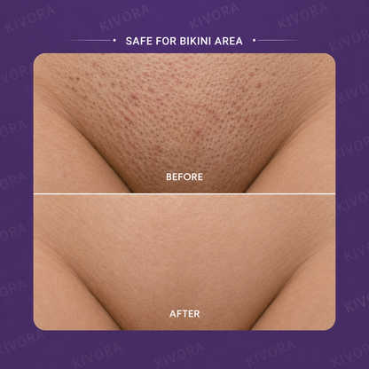 Kivora™ Hair Removal Mouse